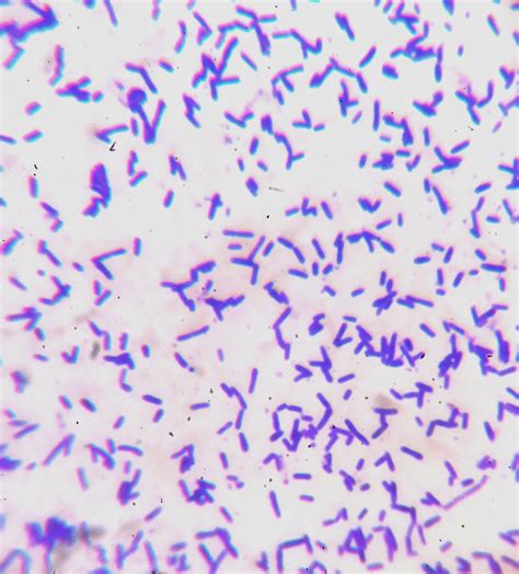 How Can I Identify These Three Types Of Gram Positive Bacilli Bacteria