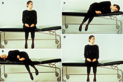 Benign Paroxysmal Positional Vertigo Causes Diagnosis Test Exercise