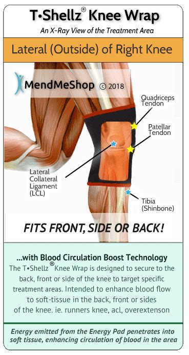 Hoffas Syndrome Fat Pad Impingement Knee