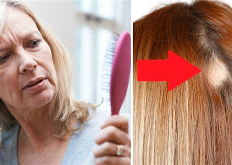 Qué hacer para que no se te caiga TANTO el cabello durante la menopausia Telenord com