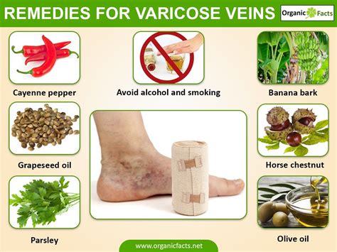 Some Of The Most Effective Home Remedies For Varicose Veins Include The