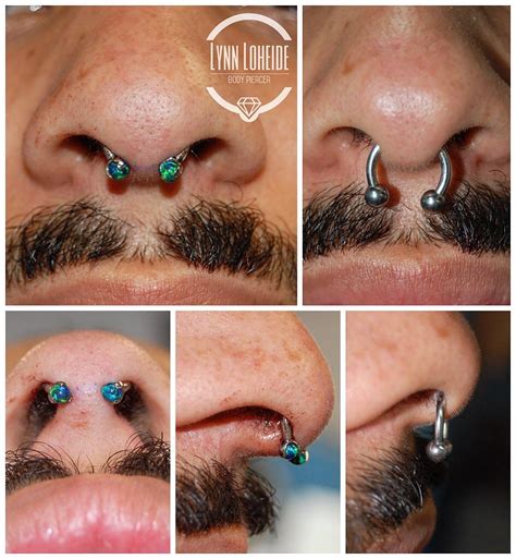 Septum Correction On The Right Is What This Client Came To Me With