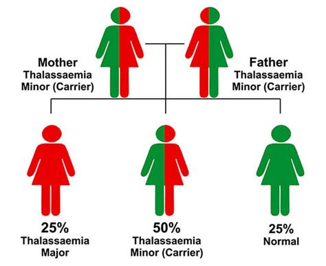 Thalassemia Origin Thalassemia Beta Thalassemia Major Causes