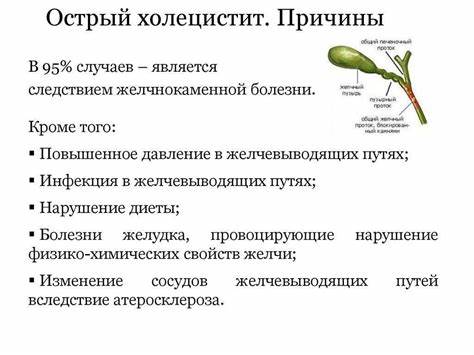 Желчекаменная болезнь у женщин и мужчин - лечение и симптомы Картинка - Желчекаменная болезнь у женщин и мужчин - лечение и симптомы