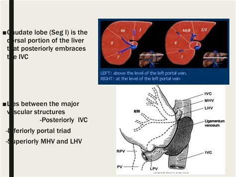 Caudate Lobe Resection By Dr Harsh Shah