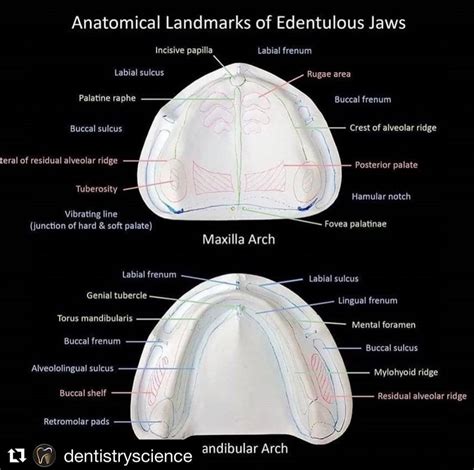 Anatomical Landmarks Of Edentulous Jaw Dental Hygiene Babe Dental Assistant Study Dental