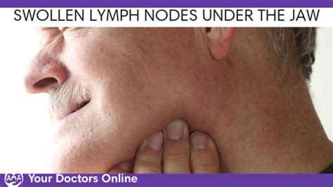 Swollen Lymph Nodes Under Jaw But Not Sick Critical Issue 2021