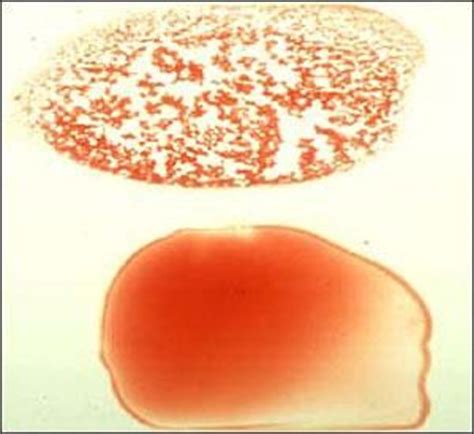 22 best IMHA Dogs images on Pinterest | Hemolytic anemia ...