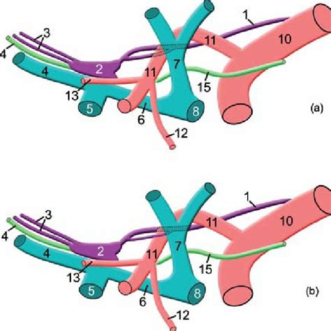Schematic Drawings Of Anatomical Variations Of The Thoracic Duct