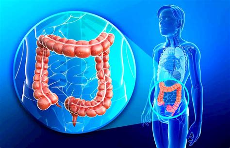 What Is Colon Infection Quanswer
