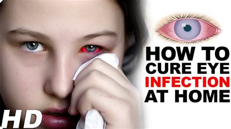 Prodesignintl How To Cure The Pink Eye At Home
