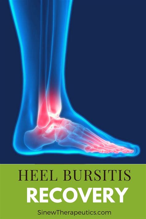 93 Best Heel Bursitis Images On Pinterest Heel Pain Sports Medicine
