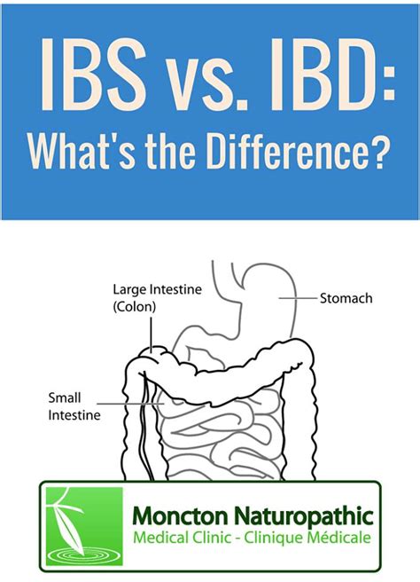 Digestive Health Ibs And Ibd Different Conditions Along The Same Spectrum Moncton