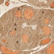 Pancreatic Acinar Cells Photograph By Thomas Deerinck Ncmir Science