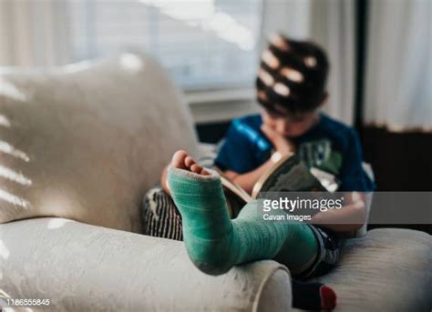 Child Broken Leg Photos And Premium High Res Pictures Getty Images