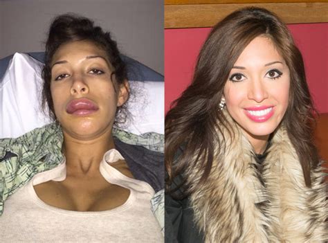Farrah Abraham S Botched Lip Injections Magically Fixed Teen Mom Star Shows Off Healthier Look