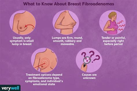 Breast Fibroadenomas Symptoms Diagnosis Treatment