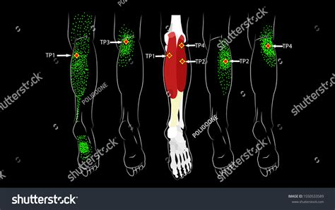 Calf Muscle Trigger Points Leg Reflected Stock Vector Royalty Free