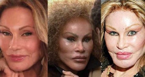 29 hollywood celebrities who have spent thousands on cosmetic surgery page 2 of 30 true activist