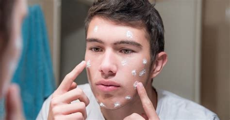 What Causes Adult Acne And How To Treat It Australian Skin Clinics