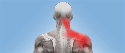 Chiropractor Richiropractic Treatments Offered For Common Neck And