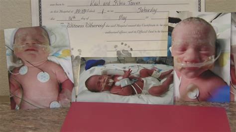 Identical Triplets Born In Texas Hospital Includes Set Of Conjoined Twins Abc7 Chicago