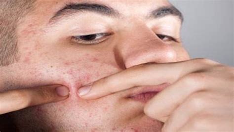 Early Signs Of Skin Cancer On Face