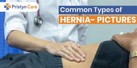 Commonly Seen Hernia Symptoms In Men Pristyn Care