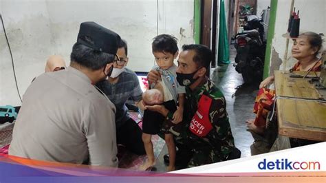 Bocah Di Tanggulangin Sidoarjo Yang Alami Kelainan Usus Akan Segera