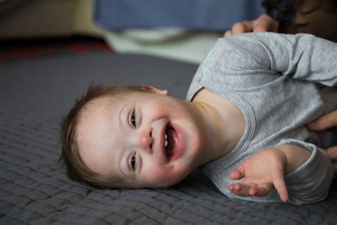 This Adorable 18 Month Old Baby With Down Syndrome Just Landed A Very