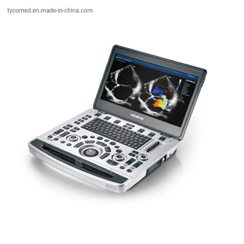 Medical Supply Portable Echocardiography Color Doppler Ultrasound
