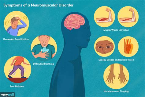 Types Of Neuromuscular Disorders 2022