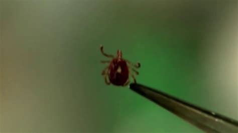 Meat Allergies From Tick Bites On The Rise Youtube