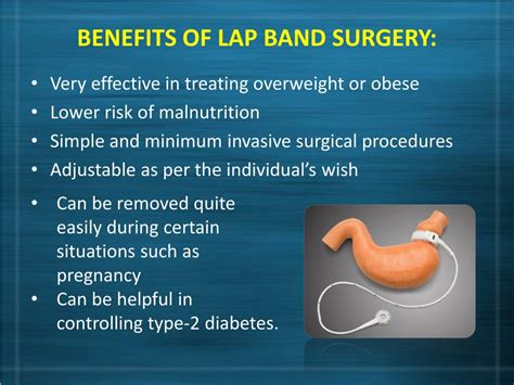 Ppt Lap Band Surgery In Los Angeles All About Lap Band Surgery