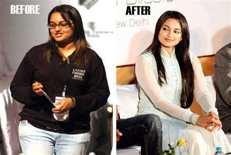 Bollywood Actress Sonakshi Sinha Before And After Weight Loss