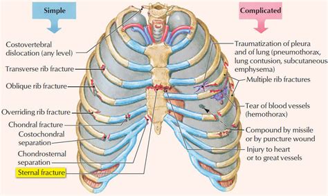 The pain or discomfort usually starts behind the. Sternum - Anatomy, Fracture, Pain and Location