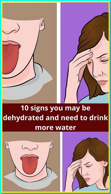 Signs Of Dehydration Healthy Loss Drink More Water Cute Little