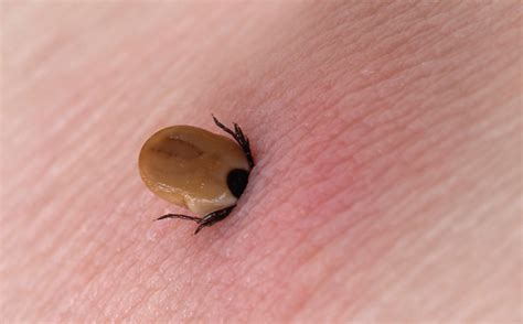 How Ticks Bite Archives Tick Control In Central Mass Lyme Disease