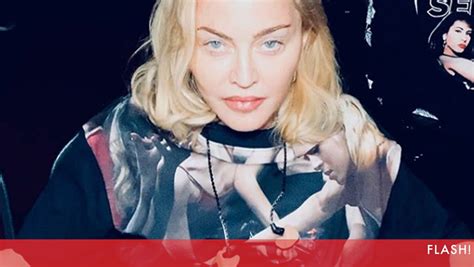 Madonna Está Irreconhecível Por Causa Das Plásticas Flashes Flash