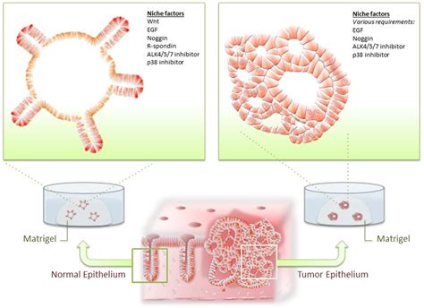 Frontiers Intestinal Tumor In A Dish Medicine
