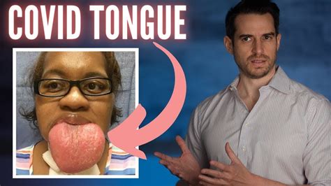 The Mystery Of Covid Tongue Explained Youtube