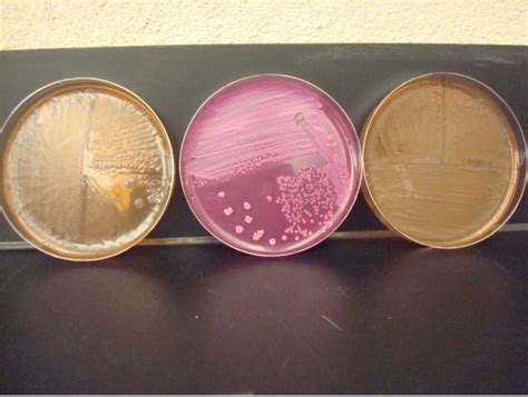 Differentiation Of Gram Negative Bacilli Red Mountain Microbiology