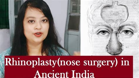 Rhinoplasty Nose Plastic Surgery In Ancient India In Bengali Ll Nose