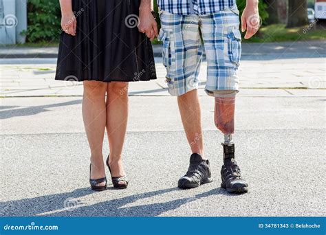 Male Amputee Wearing A Prosthetic Leg Stock Image Image Of
