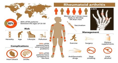 Natural Treatment For Rheumatoid Arthritis Vitalia