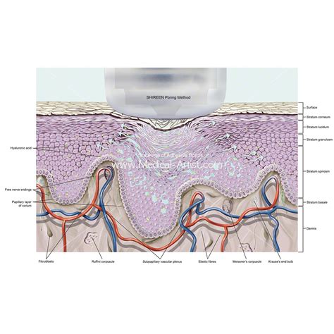 Skin Illustrations And Skin Anatomy Created By Qualified Medical Illustrators