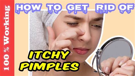 How To Get Rid Of Itchy Pimples Overnight Fast Home Remedies