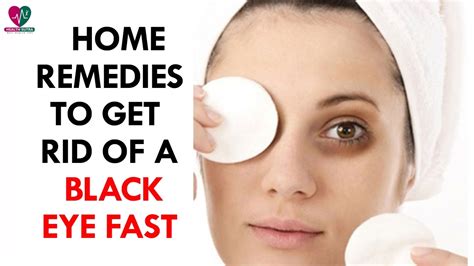 Home Remedies To Get Rid Of A Black Eye Fast Health Sutra Youtube
