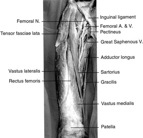 Right Femoral Nerve Femoral Nerve And Its Relevance To Chiropractic