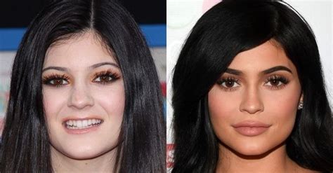 kylie jenner before and after kylie before and after kardashians before and after celebrities